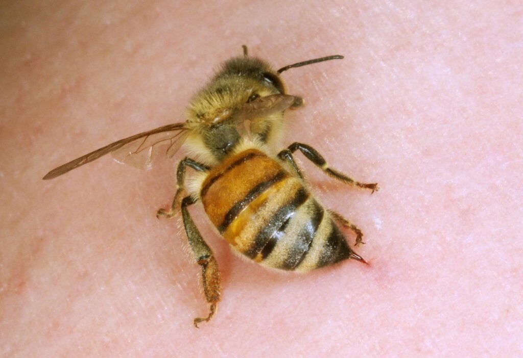 Укус пчелы: правильная первая помощь, что срочно делать при укусе